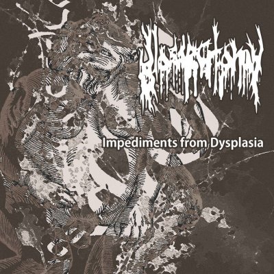 画像1: [BCE 003] Glossectomy - Impediments From Dysplasia / CD